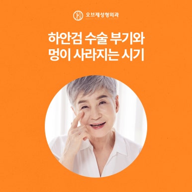 늘어지고 처지는 중년눈수술 관련 이미지 9