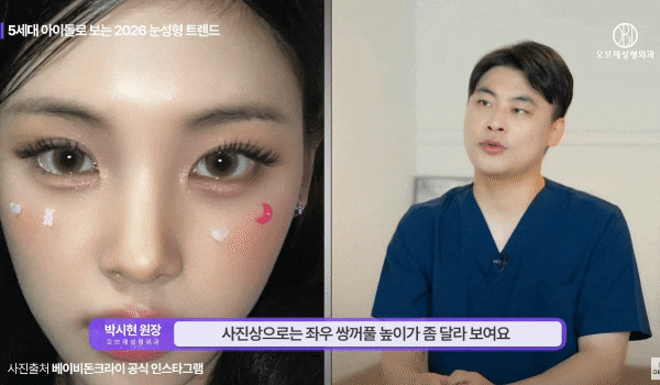 인아웃 쌍꺼풀 vs 세미아웃 쌍꺼풀, 내 눈엔 어느 쪽이 어울릴까? 관련 이미지 5