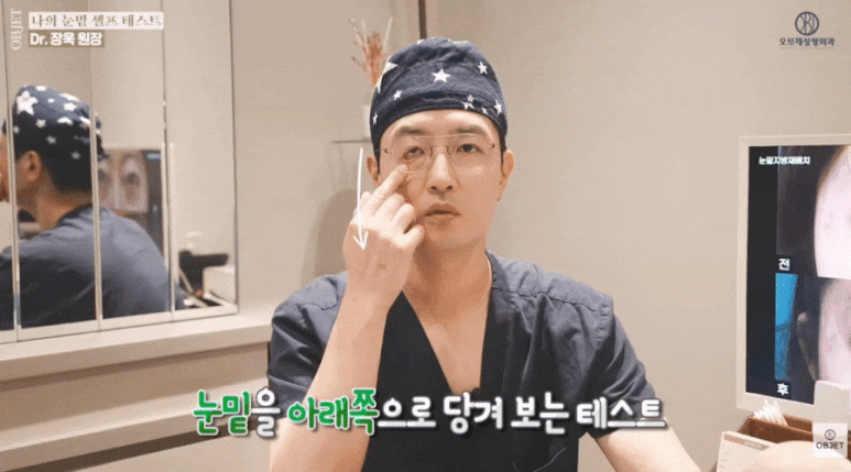 눈밑처짐 수술 고민? 장욱 원장님이 알려주는 셀프 테스트! 관련 이미지 3