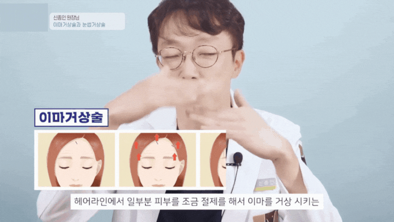 Forehead and Eyebrow Lift? A Selection Guide from Director Shin Jong-in image 13