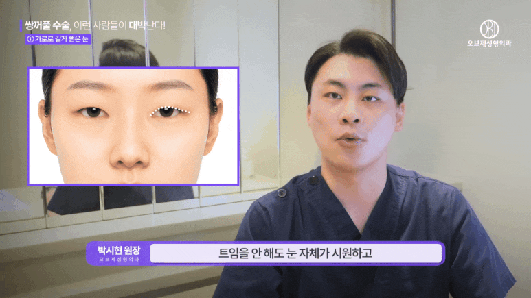 Why Double Eyelid Surgery Fails: The Crucial Difference Between Those It Works For and Those It Doesn’t image 5