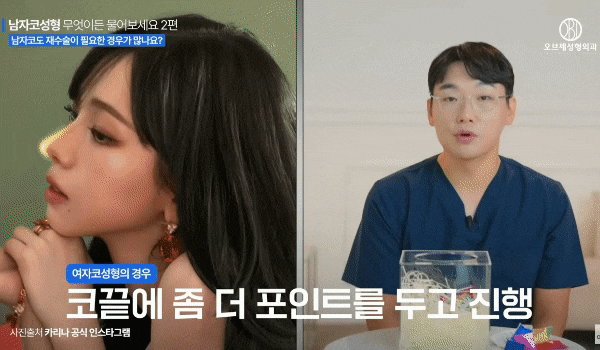 남자직선코 왜 인기 많을까? 코재수술 피하는 <TIP> 관련 이미지 2