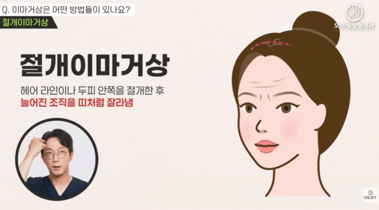 엔도타인이마거상? 신종인 원장님이 추천하는 <이유> 공개! 관련 이미지 3