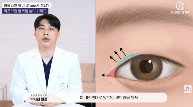 What Is the Pretty Height for an Out-Line Double Eyelid? Director Park Si-hyeon’s Answer! image 6