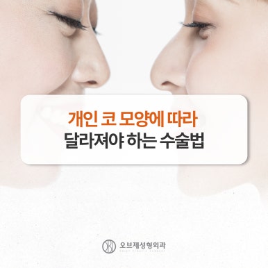 코성형보형물 실리콘or연골 나에게 맞는 방법은? 관련 이미지 8