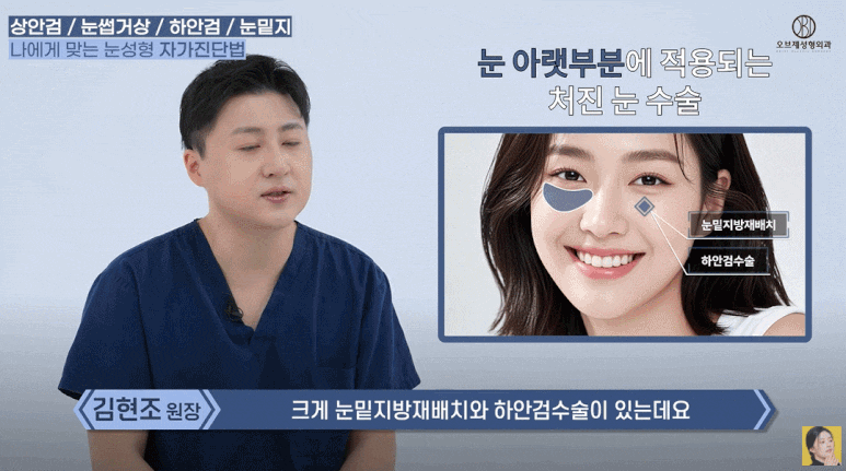 What Is the Difference Between Upper Eyelid and Lower Eyelid Surgery? Are There Different Procedures for Different Eyes? (Explanation by a Board-Certified Plastic Surgeon) image 14