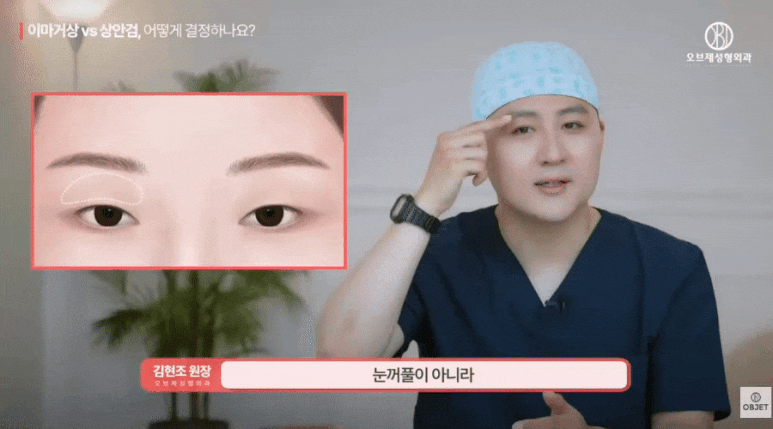 Middle-Aged Eye Surgery: Upper Blepharoplasty vs. Brow Lift — Dr. Kim Hyun-jo’s Self-Check Method! image 3