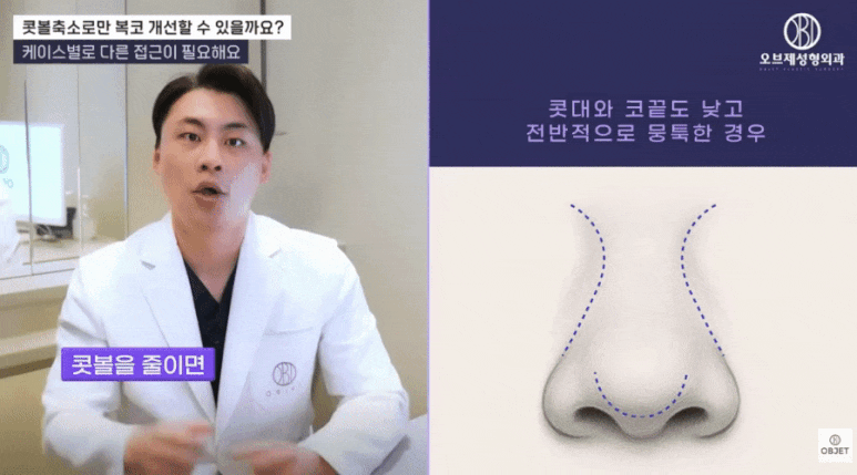 Nasal Ala Reduction Surgery: Selection Criteria as Explained by Director Park Si-hyun image 4