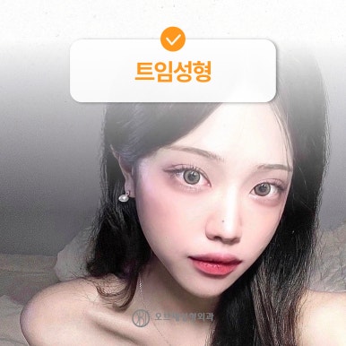 강남 쌍꺼풀수술 나에게 맞게하는 방법 관련 이미지 8