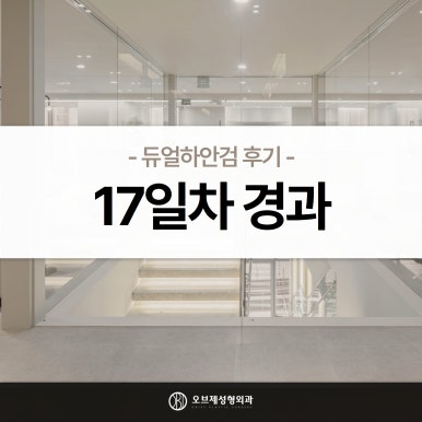 듀얼하안검 후기, 수술당일부터 69일까지 생생보고 #오브제성형외과 장욱원장님 관련 이미지 17