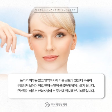 늘어지고 처지는 중년눈수술 관련 이미지 4