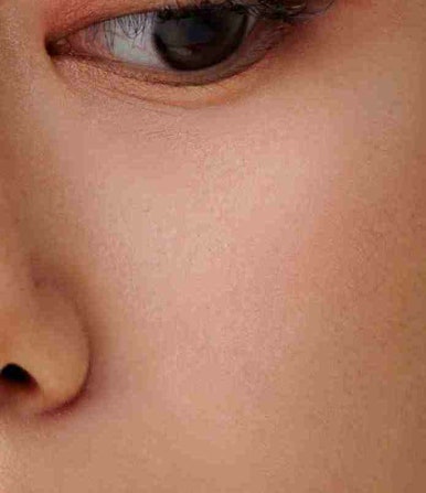 Questions About Double Eyelid Surgery in Gangnam image 13