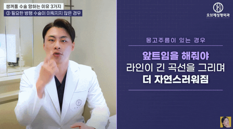 Don’t Fail Your Double Eyelid Surgery — Please Read This First. (Plastic Surgeon Tip) image 11