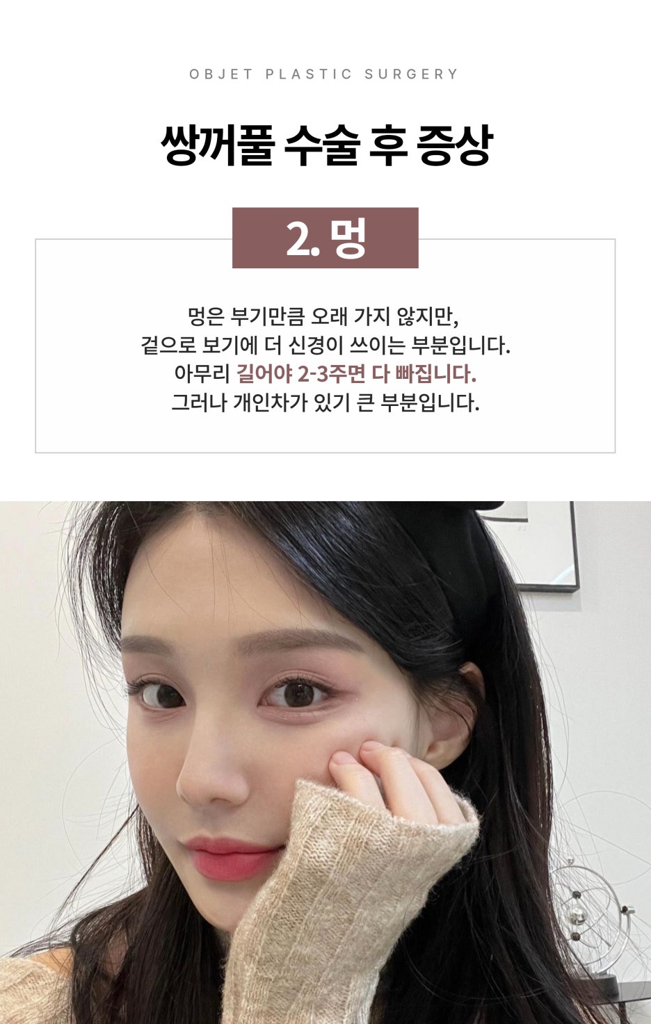 Symptoms After Double Eyelid Surgery at Gangnam Station Plastic Surgery image 5