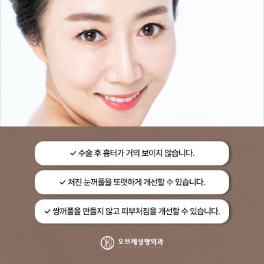 Fine Wrinkles Beside the Eyes, Brow Lift image 6