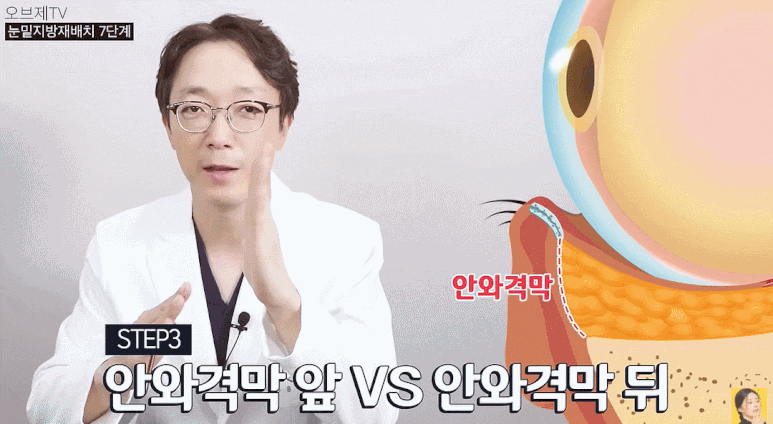Under-Eye Fat Repositioning Surgery Method? Do It This Way and Worries About Recurrence Disappear. image 8