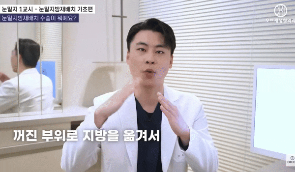 Under-Eye Fat Repositioning Before-and-After Results? Why Celebrities Choose It image 7