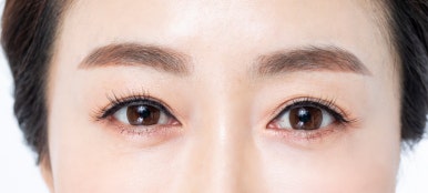 The Difference Between Lower Eye Fat Repositioning and Lower Blepharoplasty, the Snapback Test, and the Distraction Test #Gangnam Plastic Surgery Objet image 5