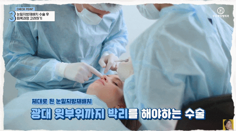눈밑지 재발 이유? 세 가지만 알면 눈밑지방재배치 성공할 수 있어요! 관련 이미지 14