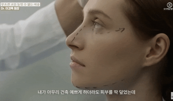 Gangnam Rhinoplasty Clinic: Does Nose Surgery Make Your Eyes Look Closer Together? It’s a <Misconception>! image 8