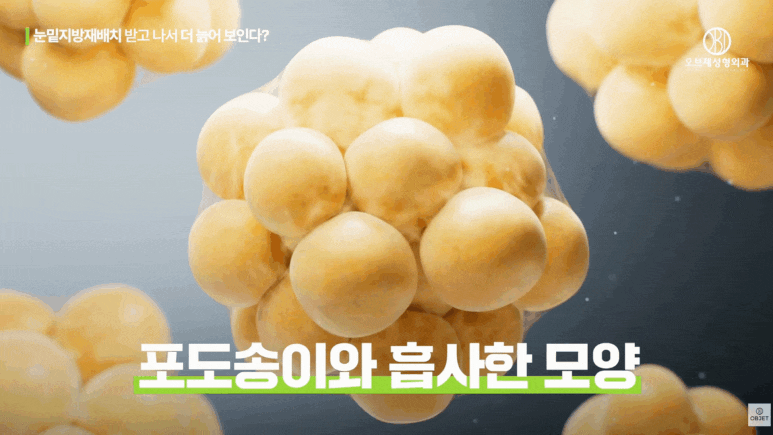 눈밑지 부작용 걱정 끝내려면 이 3가지는 꼭 보셔야 해요! 관련 이미지 9