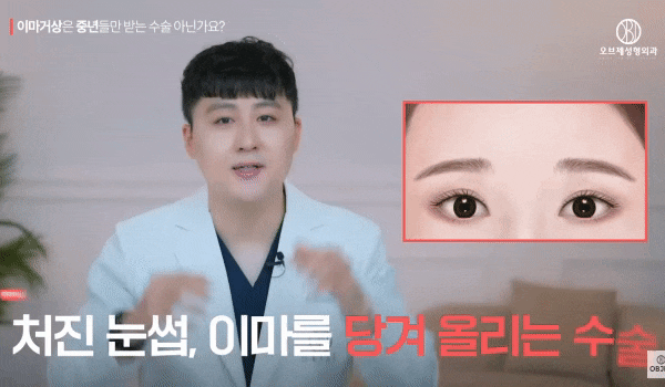 Can the Effects of Forehead Lift Surgery Change Even OO? How It Differs from Double Eyelid Surgery! image 5