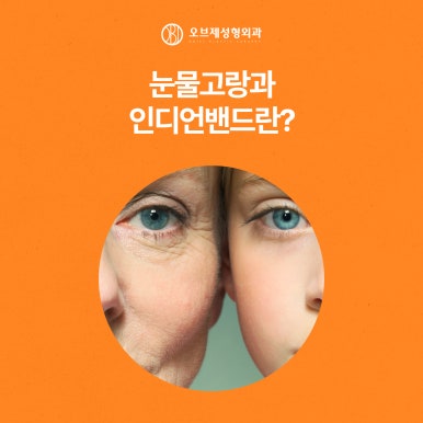 늘어지고 처지는 중년눈수술 관련 이미지 7