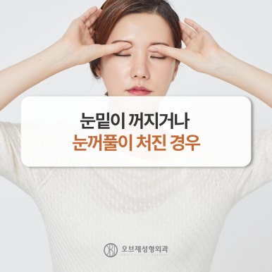 Where to Get Good Revision Eye Surgery: 고민 After a First Failure image 7