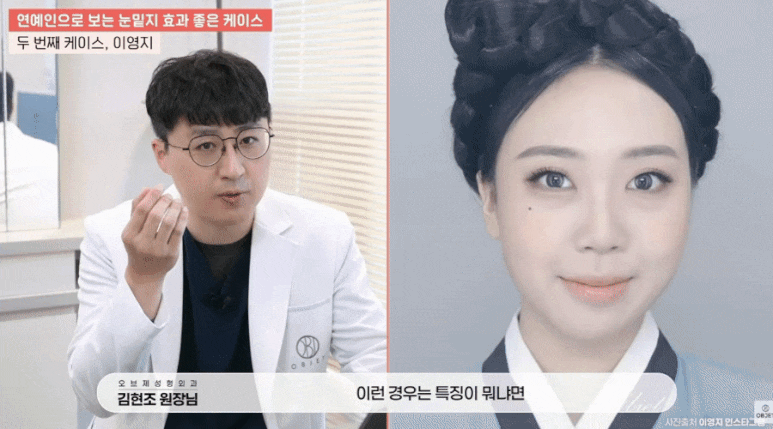 눈밑지 병원? 관련 이미지 10