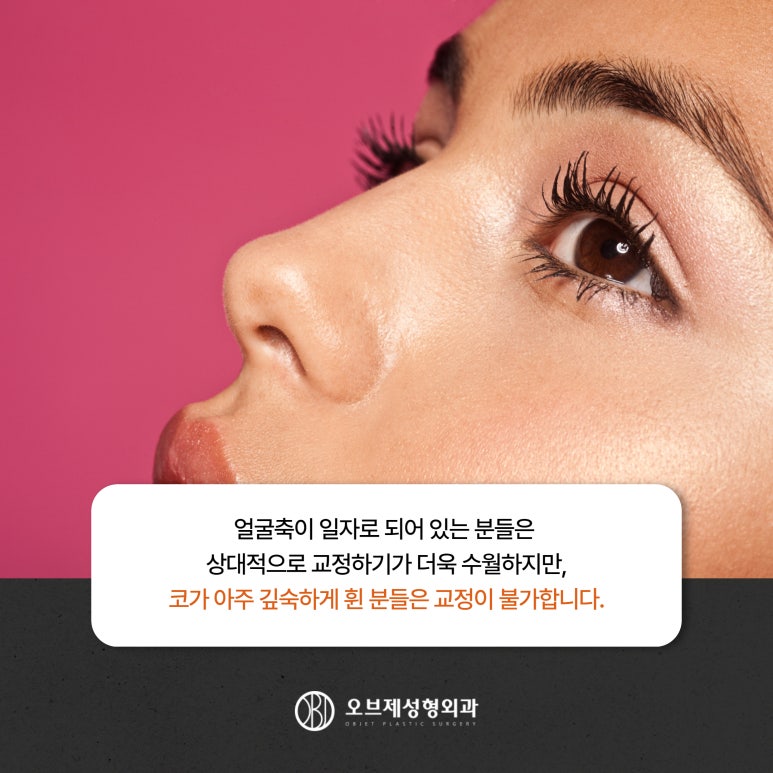 Where Should You Go for Correcting a Crooked Nose? #Director Lee Kyung-mook image 6