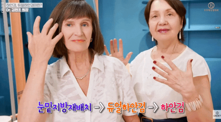눈밑지 성형외과 유지 기간 평생 갈까? 김현조 원장님 정리 관련 이미지 10