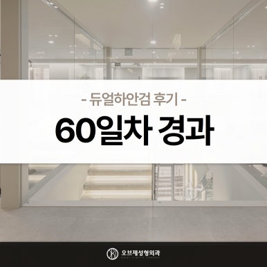듀얼하안검 후기, 수술당일부터 69일까지 생생보고 #오브제성형외과 장욱원장님 관련 이미지 23