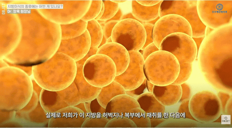 Why Satisfaction Differs Before and After Facial Fat Grafting | Dr. Jang Uk’s Summary image 7