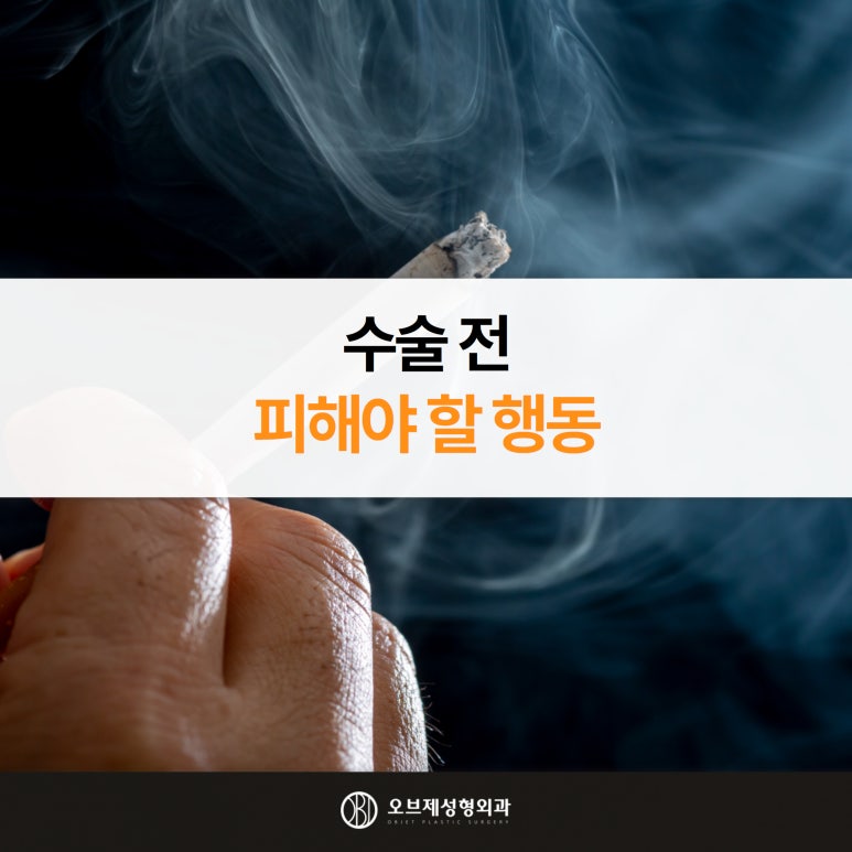 듀얼하안검 주의해야 할 사항 관련 이미지 5