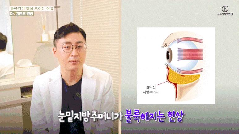 50대 하안검수술후기, 동안 효과는 여기서 갈린다고요? 관련 이미지 5