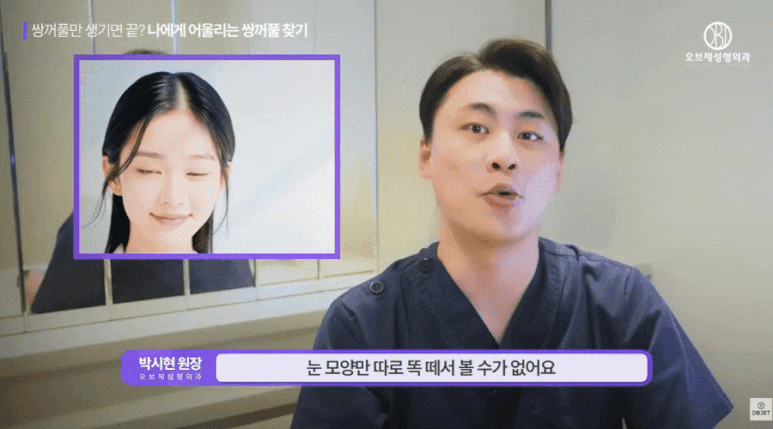 쌍수 후기 라인 보지 마세요! 박시현 원장님의 선택 기준! 관련 이미지 6