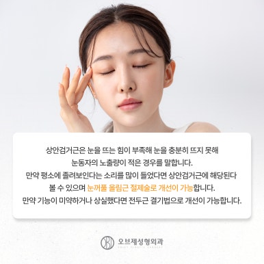 강남 쌍꺼풀수술 나에게 맞게하는 방법 관련 이미지 7