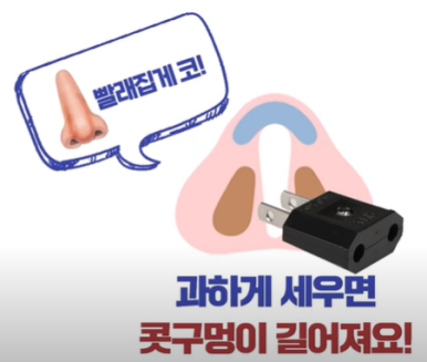 코성형 콧구멍 110V 빨래집게 코 #이경묵원장님 관련 이미지 6