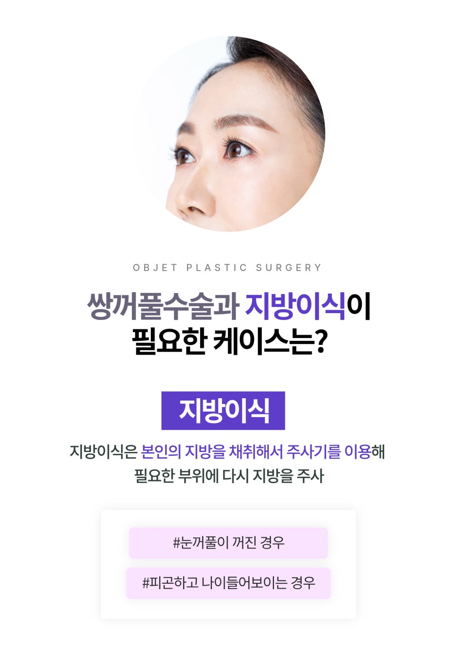 강남쌍수 함께 하면 좋은 수술 오브제성형외과 관련 이미지 5