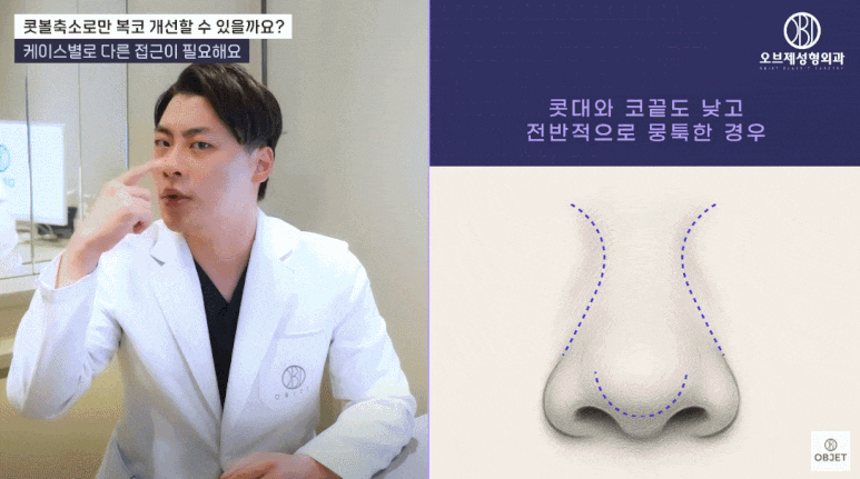 콧볼축소잘하는곳은 복코수술에서 콧볼만 보지 않습니다! (오브제성형외과 복코성형 TIP!) 관련 이미지 4