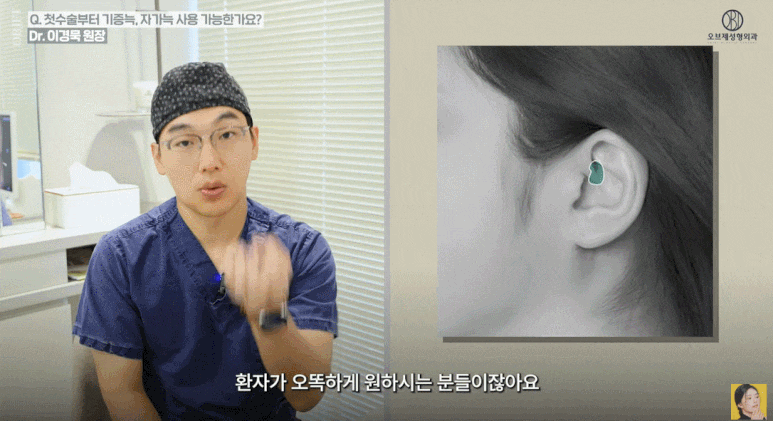 Everything You’ve Been Wondering About Rhinoplasty, Explained by a Rhinoplasty Clinic! (Answer from a Board-Certified Plastic Surgeon) image 2