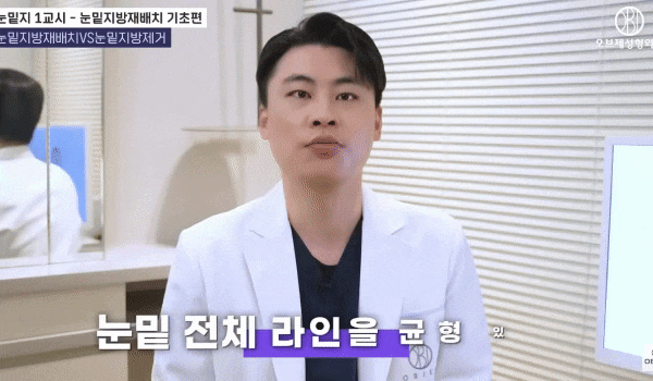 Under-Eye Fat Repositioning Before-and-After Results? Why Celebrities Choose It image 10