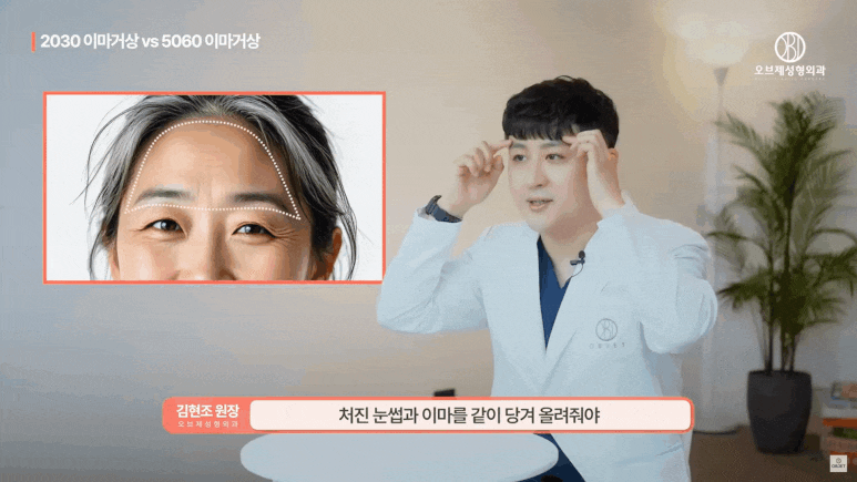 Forehead Lift in Your 20s: Why MZ Is Choosing It Instead of Double Eyelid Surgery image 4