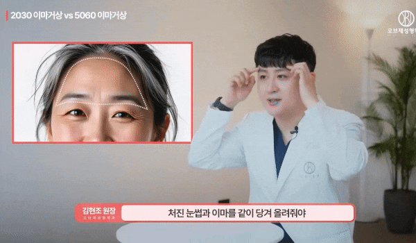 Can the Effects of Forehead Lift Surgery Change Even OO? How It Differs from Double Eyelid Surgery! image 8