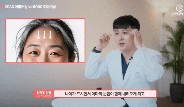 Can the Effects of Forehead Lift Surgery Change Even OO? How It Differs from Double Eyelid Surgery! image 4