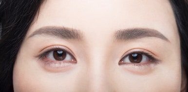 The Difference Between Lower Eye Fat Repositioning and Lower Blepharoplasty, the Snapback Test, and the Distraction Test #Gangnam Plastic Surgery Objet image 4