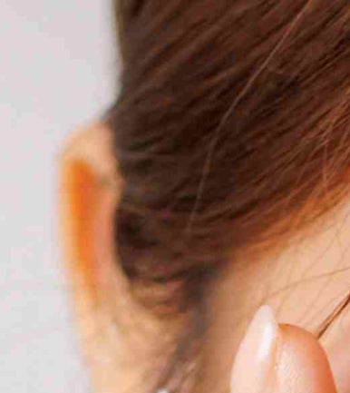 The Difference Between Upper Blepharoplasty and Incisional Double Eyelid Surgery #Director Kim Hyun-jo image 8