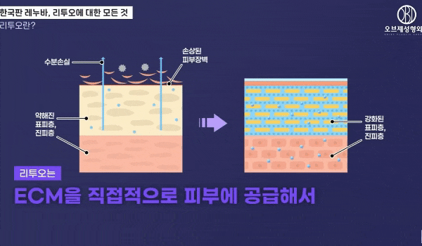 리투오 리쥬란 여름맞이 스킨부스터 박시현 원장님의 선택은? 관련 이미지 7