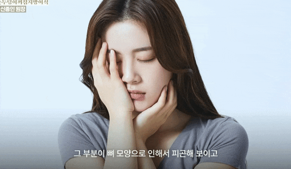 Upper Eyelid Fat Grafting? Read This If You’re Tired of Being Told You Look Tired! image 4