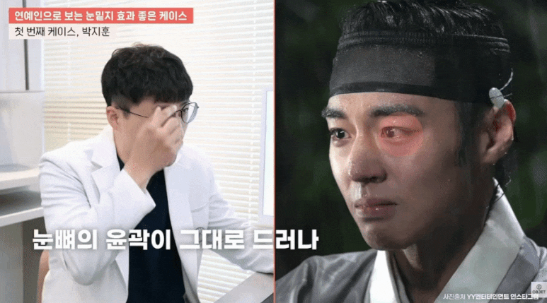 눈밑지 병원? 관련 이미지 7